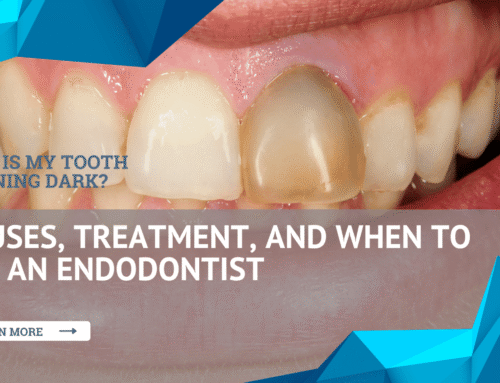 Why Is My Tooth Turning Dark? Causes, Treatment, and When to See an Endodontist