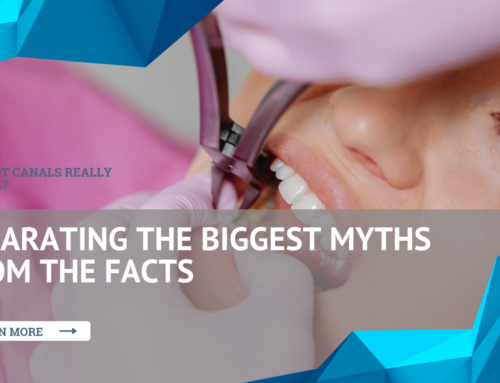 Are Root Canals Really Painful? Separating the Biggest Myths from the Facts