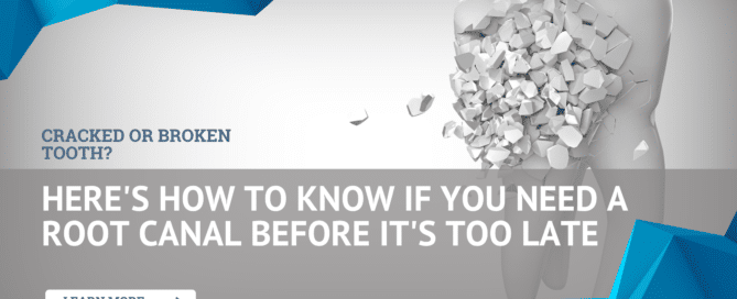 Cracked or Broken Tooth Here's How to Know If You Need a Root Canal Before It's Too Late