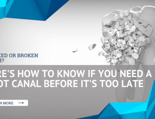 Cracked or Broken Tooth? Here’s How to Know If You Need a Root Canal Before It’s Too Late