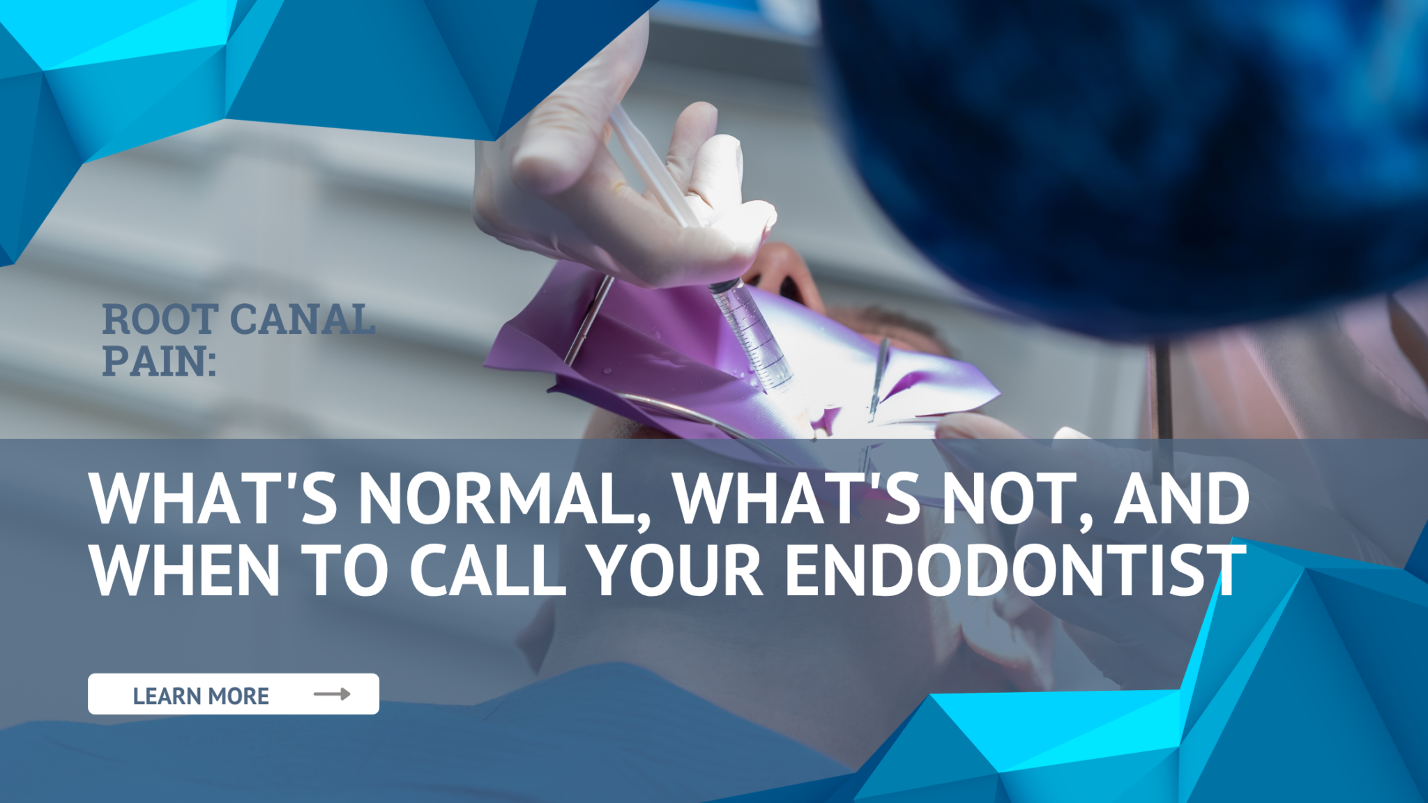 Root Canal Pain What's Normal, What's Not, and When to Call Your Endodontist