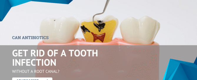 Can Antibiotics Get Rid of a Tooth Infection Without a Root Canal