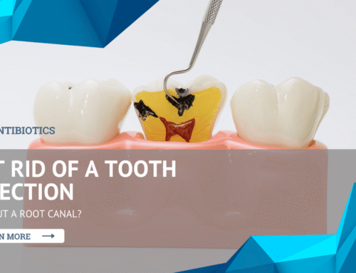 Can Antibiotics Get Rid of a Tooth Infection Without a Root Canal?