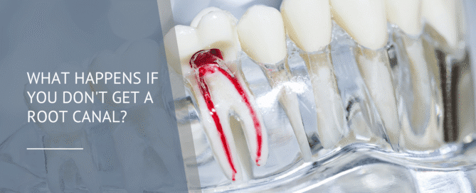 What Happens If You Don't Get a Root Canal