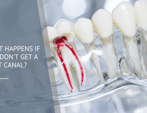 What Happens If You Don’t Get a Root Canal?