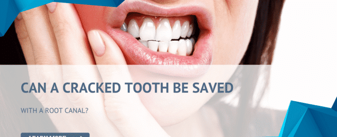 evaluating whether a cracked tooth can be saved with a root canal