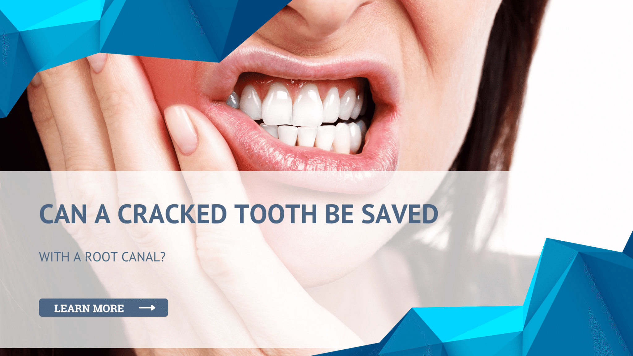 evaluating whether a cracked tooth can be saved with a root canal