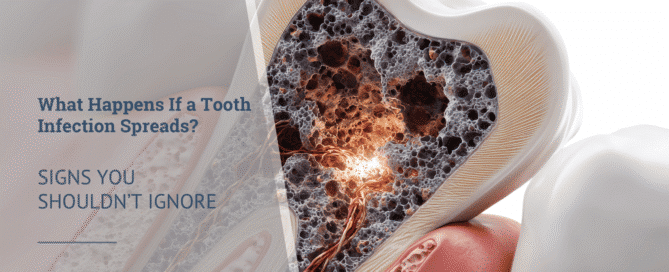 Signs of a spreading tooth infection