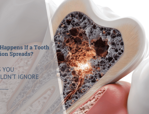 What Happens If a Tooth Infection Spreads? Signs You Shouldn’t Ignore
