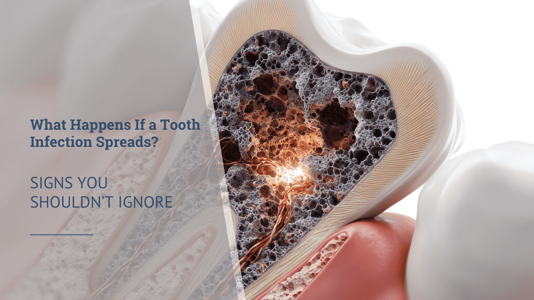 Signs of a spreading tooth infection
