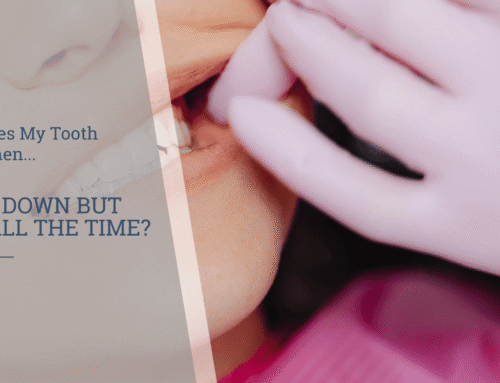 Why Does My Tooth Hurt When I Bite Down but Not All the Time?