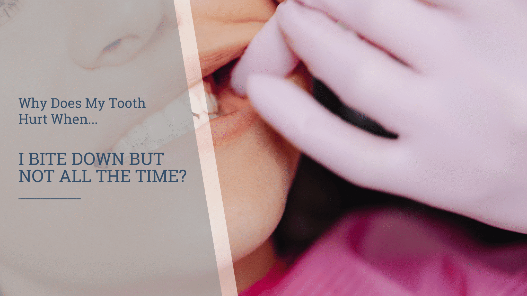 Tooth pain when biting down or chewing